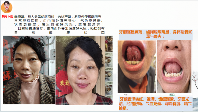 2026非遗辅元汤诚招合伙人.合伙创富.大势所趋