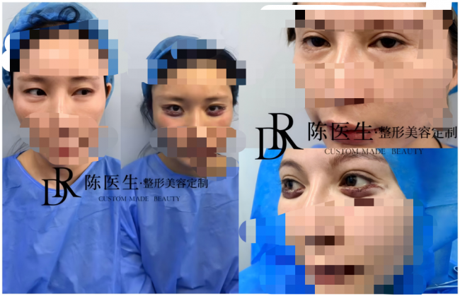 宝颜汇创始人陈辰受邀担任CCTV《完美变型计》医学抗衰专家